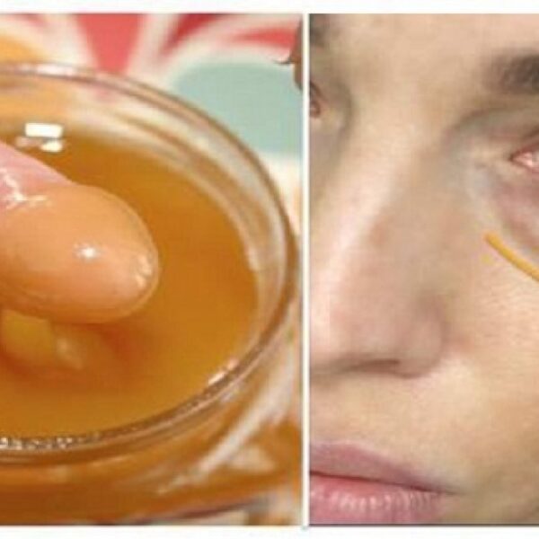 علاج الهالات السوداء بمكونات اقتصادية